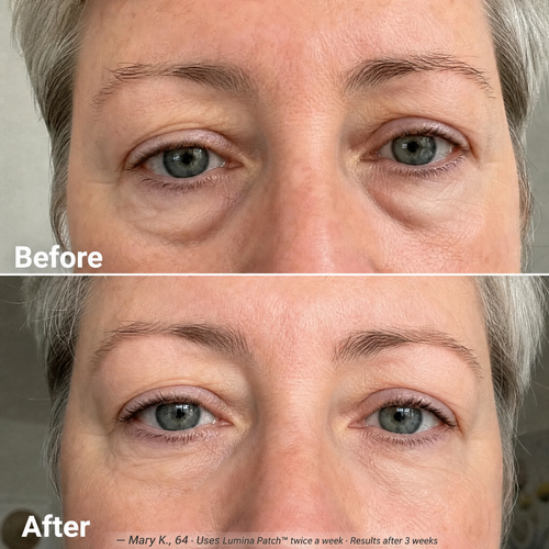 Lumina Patch™ - Wake Up Looking Rested !
