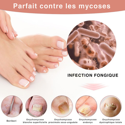 LumiPure™ - Photothérapie douce anti-mycose
