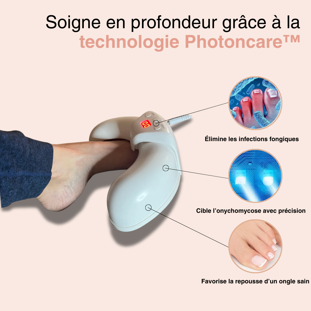 LumiPure™ - Photothérapie douce anti-mycose