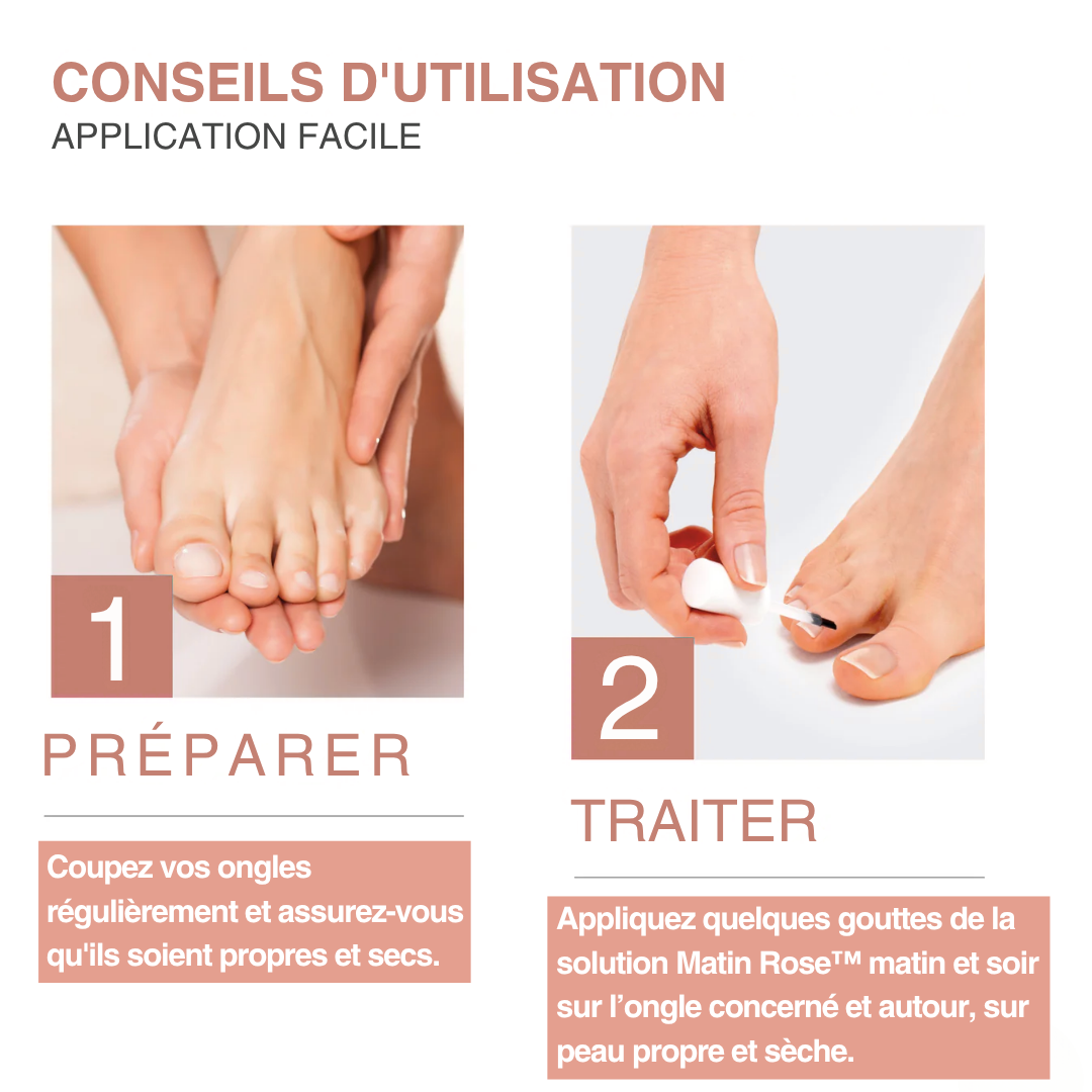 Solution anti-mycose - Formule 100% naturelle