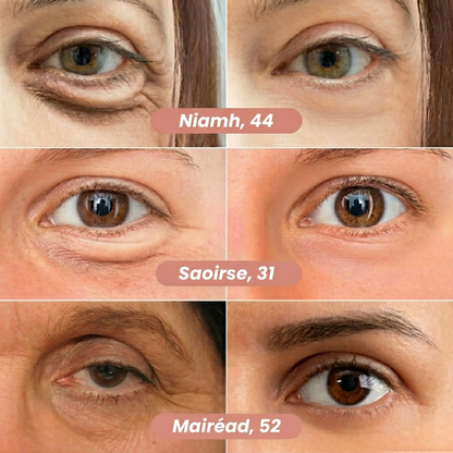 Lumina Patch™ - New Generation Under-Eye Patches